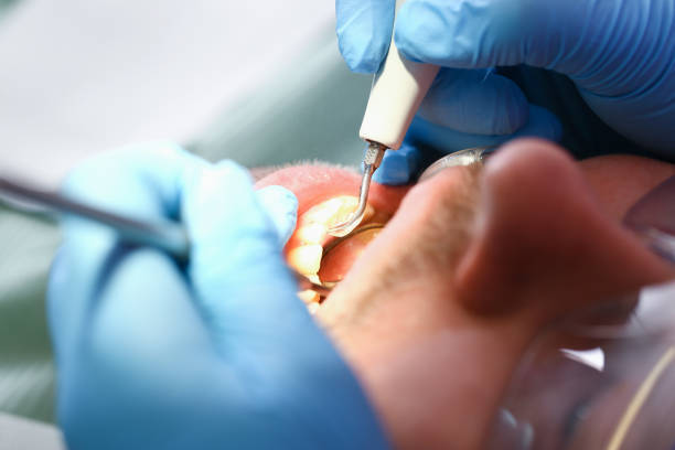 Best Dental Abscess Treatment in Woodsville, NH