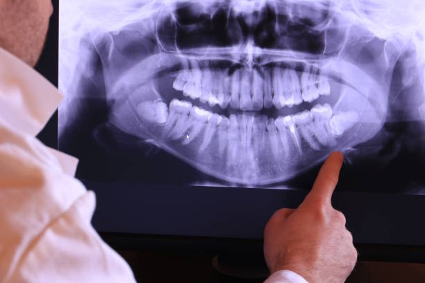 Best Emergency Root Canal Therapy in Woodsville, NH